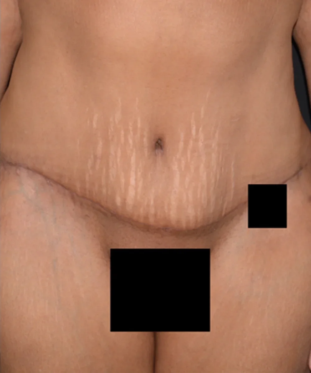 abdom-KJ-1 copy-large