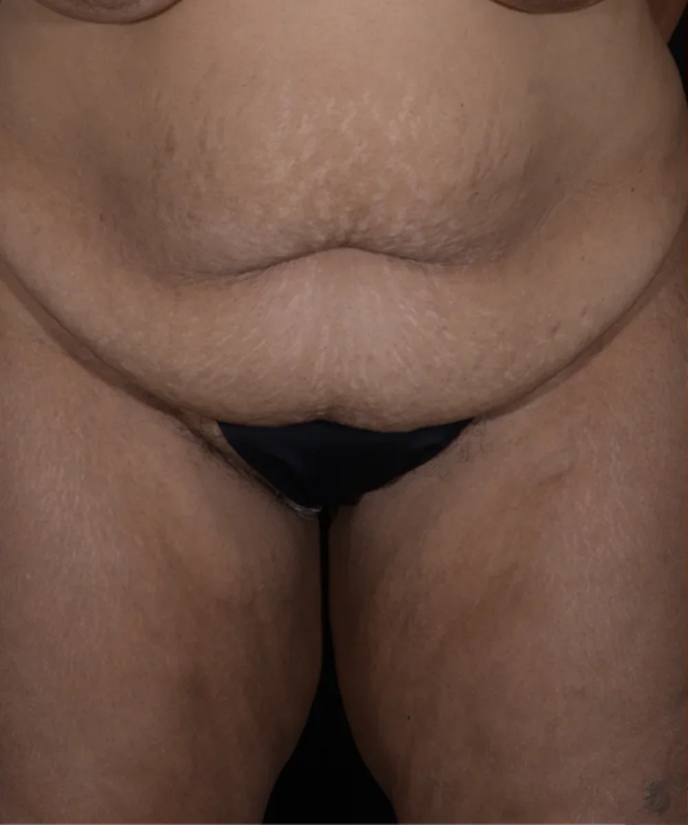 abdom-KJ-2 copy-large