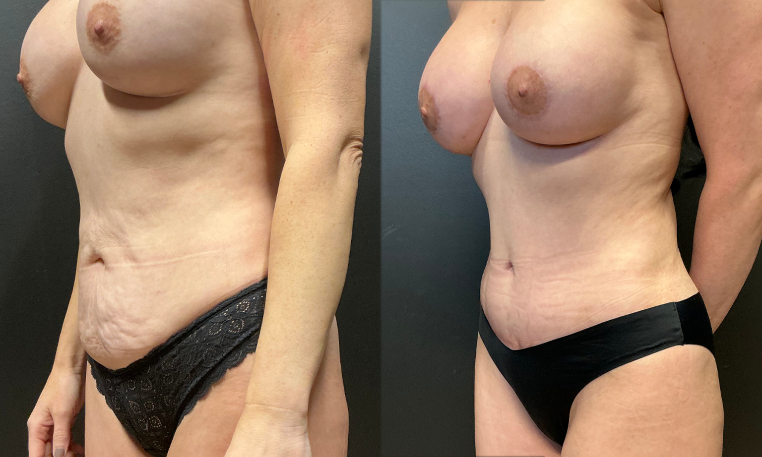 tum (3)
